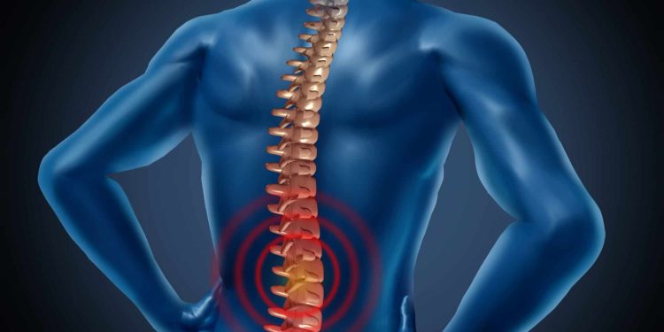 Can Your Spine Survive Sports? Six Crucial Ways to Guard It While Getting Your Game On