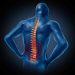 Can Your Spine Survive Sports? Six Crucial Ways to Guard It While Getting Your Game On