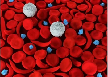 Managing Sickle-cell Anemia: New Treatment Insights