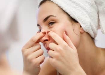 The Pimple Predicament & Mastering the Art of Clear Skin