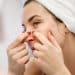 The Pimple Predicament & Mastering the Art of Clear Skin