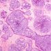Carcinogenic Cells and IGF-1 DES Research